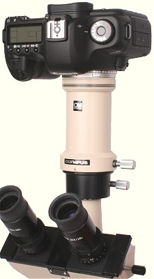 Canon EOS digital SLR on an Olympus CK2 inverted microscope