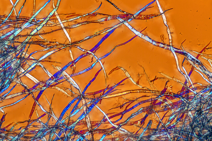 Teased toilet tissue using crossed polarisers plus retarder